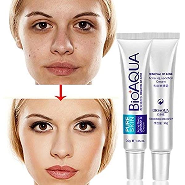 Bioaqua Acne Scar Cream