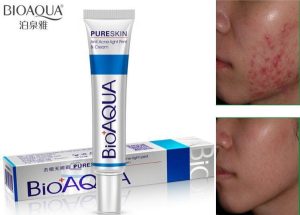 acne scar cream at Best Price in Pakistan