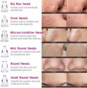 Multifunctional Blackhead Remover in Pakistan.